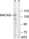 Anti-NACAD antibody used in Western Blot (WB). GTX87574