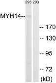 Anti-MYH14 antibody used in Western Blot (WB). GTX87578