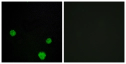 Anti-HLX1 antibody used in Immunocytochemistry/ Immunofluorescence (ICC/IF). GTX87590
