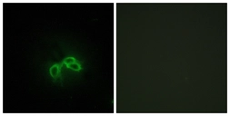Anti-BLCAP antibody used in Immunocytochemistry/ Immunofluorescence (ICC/IF). GTX87601