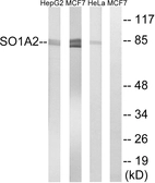 Anti-SLCO1A2 antibody used in Western Blot (WB). GTX87607