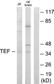 Anti-TEF antibody used in Western Blot (WB). GTX87608