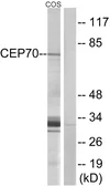 Anti-CEP70 antibody used in Western Blot (WB). GTX87611