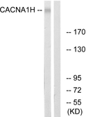 Anti-Cav3.2 antibody used in Western Blot (WB). GTX87612