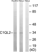 Anti-C1QL2 antibody used in Western Blot (WB). GTX87613