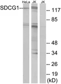 Anti-NEMF antibody used in Western Blot (WB). GTX87615