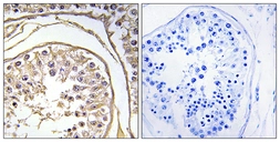 Anti-BAGE2 antibody used in IHC (Paraffin sections) (IHC-P). GTX87618