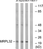 Anti-MRPL32 antibody used in Western Blot (WB). GTX87619