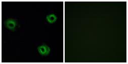 Anti-NTSR2 antibody used in Immunocytochemistry/ Immunofluorescence (ICC/IF). GTX87621