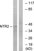 Anti-NTSR2 antibody used in Western Blot (WB). GTX87621