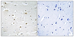 Anti-DDX3Y antibody used in IHC (Paraffin sections) (IHC-P). GTX87622