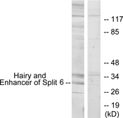 Anti-HES6 antibody used in Western Blot (WB). GTX87637