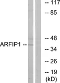 Anti-ARFIP1 antibody used in Western Blot (WB). GTX87641