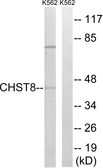 Anti-CHST8 antibody used in Western Blot (WB). GTX87645