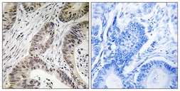 Anti-TUT1 antibody used in IHC (Paraffin sections) (IHC-P). GTX87654