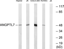 Anti-ANGPTL7 antibody used in Western Blot (WB). GTX87669