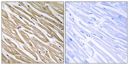 Anti-C5orf13 antibody used in IHC (Paraffin sections) (IHC-P). GTX87670