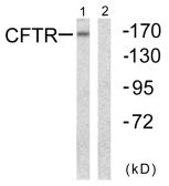 Anti-CFTR antibody used in Western Blot (WB). GTX87672