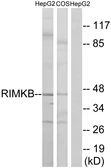 Anti-RIMKB antibody used in Western Blot (WB). GTX87679