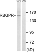 Anti-RAB3GAP2 antibody used in Western Blot (WB). GTX87680