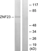 Anti-ZNF23 antibody used in Western Blot (WB). GTX87687