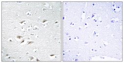 Anti-ZEB2 antibody used in IHC (Paraffin sections) (IHC-P). GTX87688