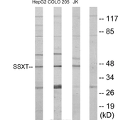 Anti-SS18 antibody used in Western Blot (WB). GTX87692