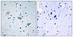 Anti-GPR158 antibody used in IHC (Paraffin sections) (IHC-P). GTX87693