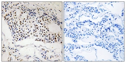 Anti-MYSM1 antibody used in IHC (Paraffin sections) (IHC-P). GTX87695