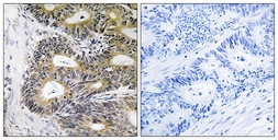 Anti-TRAPPC6A antibody used in IHC (Paraffin sections) (IHC-P). GTX87700