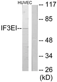 Anti-EIF3L antibody used in Western Blot (WB). GTX87704