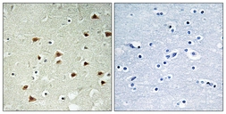 Anti-ABHD14B antibody used in IHC (Paraffin sections) (IHC-P). GTX87706