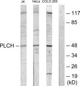 Anti-GPAT3 antibody used in Western Blot (WB). GTX87708