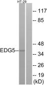 Anti-EDG5 antibody used in Western Blot (WB). GTX87713