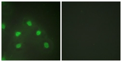 Anti-hnRNP L antibody used in Immunocytochemistry/ Immunofluorescence (ICC/IF). GTX87723