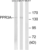 Anti-PPP1R3A antibody used in Western Blot (WB). GTX87725