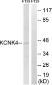 Anti-KCNK4 antibody used in Western Blot (WB). GTX87726