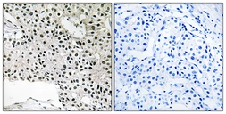 Anti-TCEAL4 antibody used in IHC (Paraffin sections) (IHC-P). GTX87730