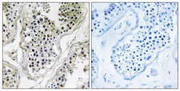 Anti-ATXN7L1 antibody used in IHC (Paraffin sections) (IHC-P). GTX87736