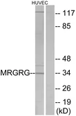 Anti-MRGPRG antibody used in Western Blot (WB). GTX87742