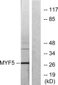 Anti-MYF5 antibody used in Western Blot (WB). GTX87746