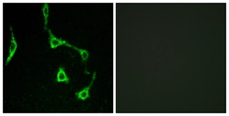 Anti-Cadherin 10 antibody used in Immunocytochemistry/ Immunofluorescence (ICC/IF). GTX87749