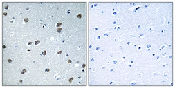 Anti-KLHL29 antibody used in IHC (Paraffin sections) (IHC-P). GTX87752