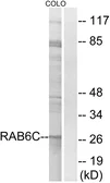 Anti-RAB6C antibody used in Western Blot (WB). GTX87758