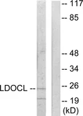 Anti-LDOCL antibody used in Western Blot (WB). GTX87764