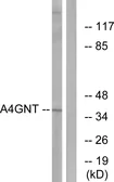 Anti-A4GNT antibody used in Western Blot (WB). GTX87765