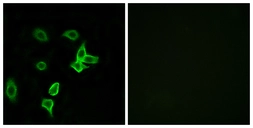 Anti-KANK2 antibody used in Immunocytochemistry/ Immunofluorescence (ICC/IF). GTX87782