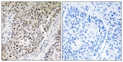 Anti-ZNF608 antibody used in IHC (Paraffin sections) (IHC-P). GTX87788