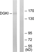Anti-DGKI antibody used in Western Blot (WB). GTX87789