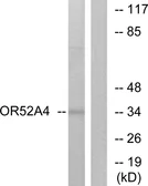 Anti-OR52A4 antibody used in Western Blot (WB). GTX87794